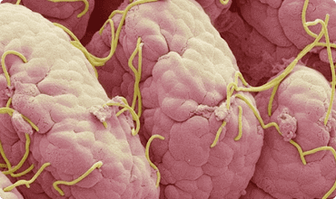 Parasitas intestinais causam 80% das doenças