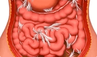 Parasitas intestinais destroem órgãos internos