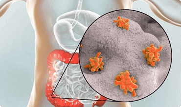 Parasitas intestinais libertam toxinas